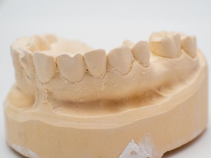 A Woman is Pointing at Her Missing Tooth in Her Mouth — Burleigh Heads Denture Clinic Gold Coast in Burleigh Heads, QLD A close up of a model of a person 's teeth on a white surface. — Burleigh Heads Denture Clinic Gold Coast in Burleigh Heads, QLD