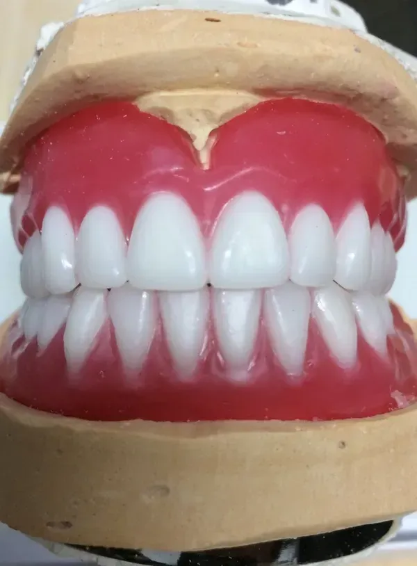 A close up of a model of a person 's teeth — Burleigh Heads Denture Clinic Gold Coast in Burleigh Heads, QLD