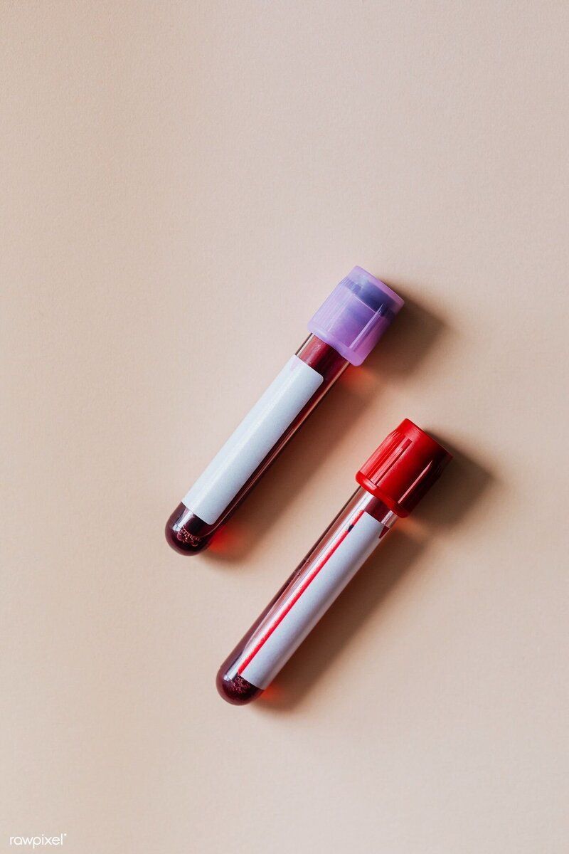 blood vials