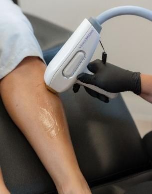 A woman is getting a hair removal treatment on her leg