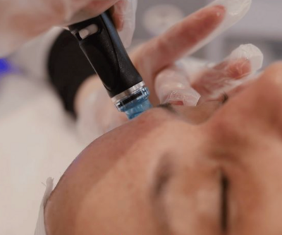 A woman is getting a facial treatment with a machine on her face.