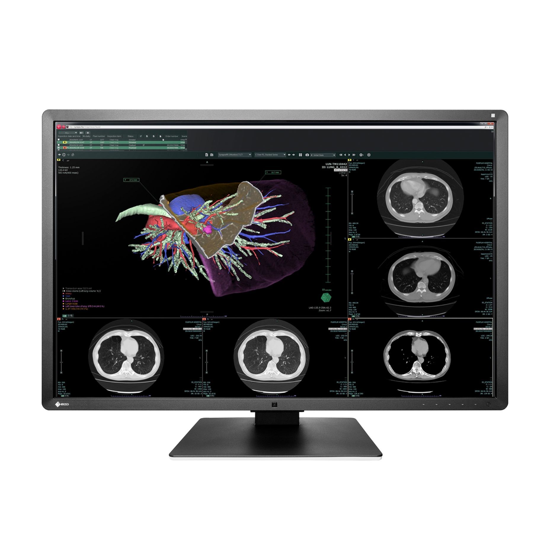 RX660-BK EIZO RadiForce RX660 Color 6MP PACS Diagnostic Monitor