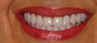 A close up of a woman 's mouth with red lipstick and white teeth.