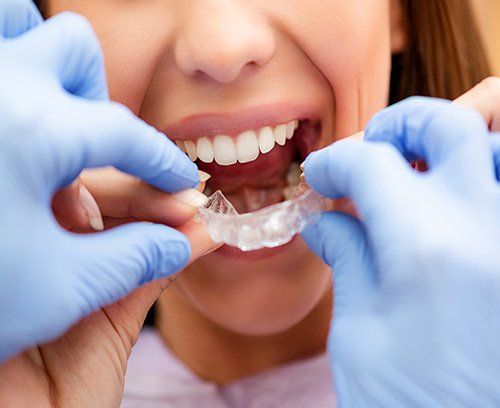 A woman is getting her teeth straightened by a dentist.