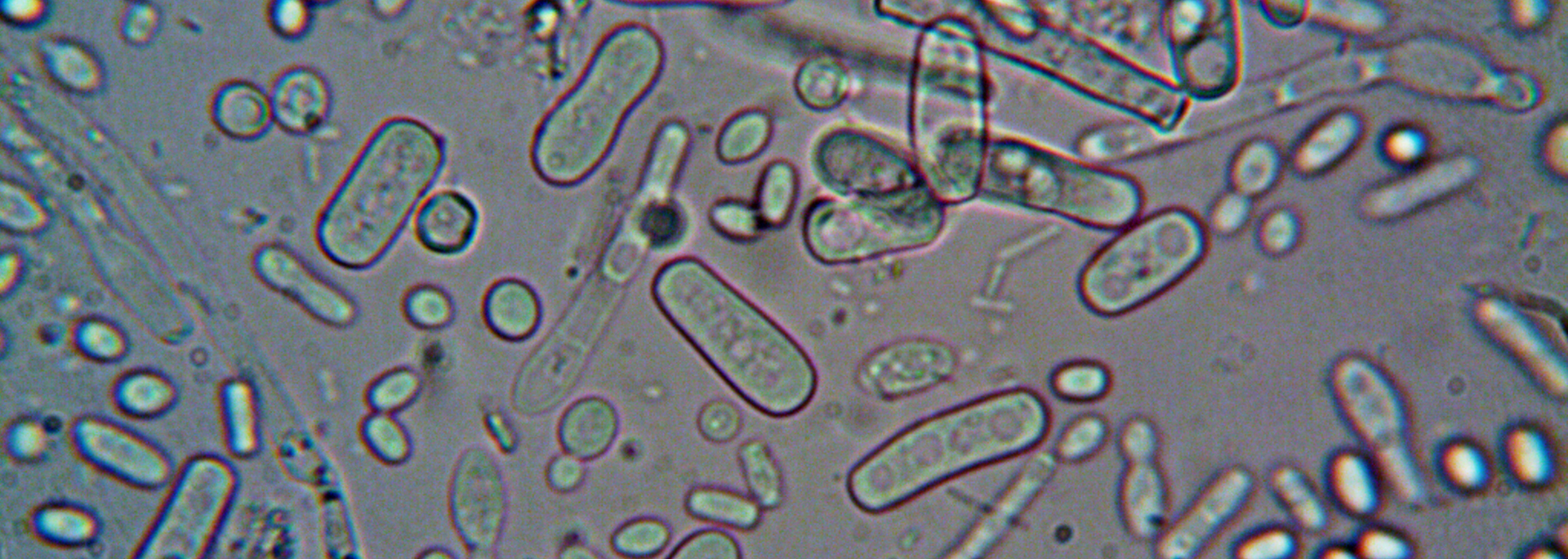 Picture of Bacteria under a microscope