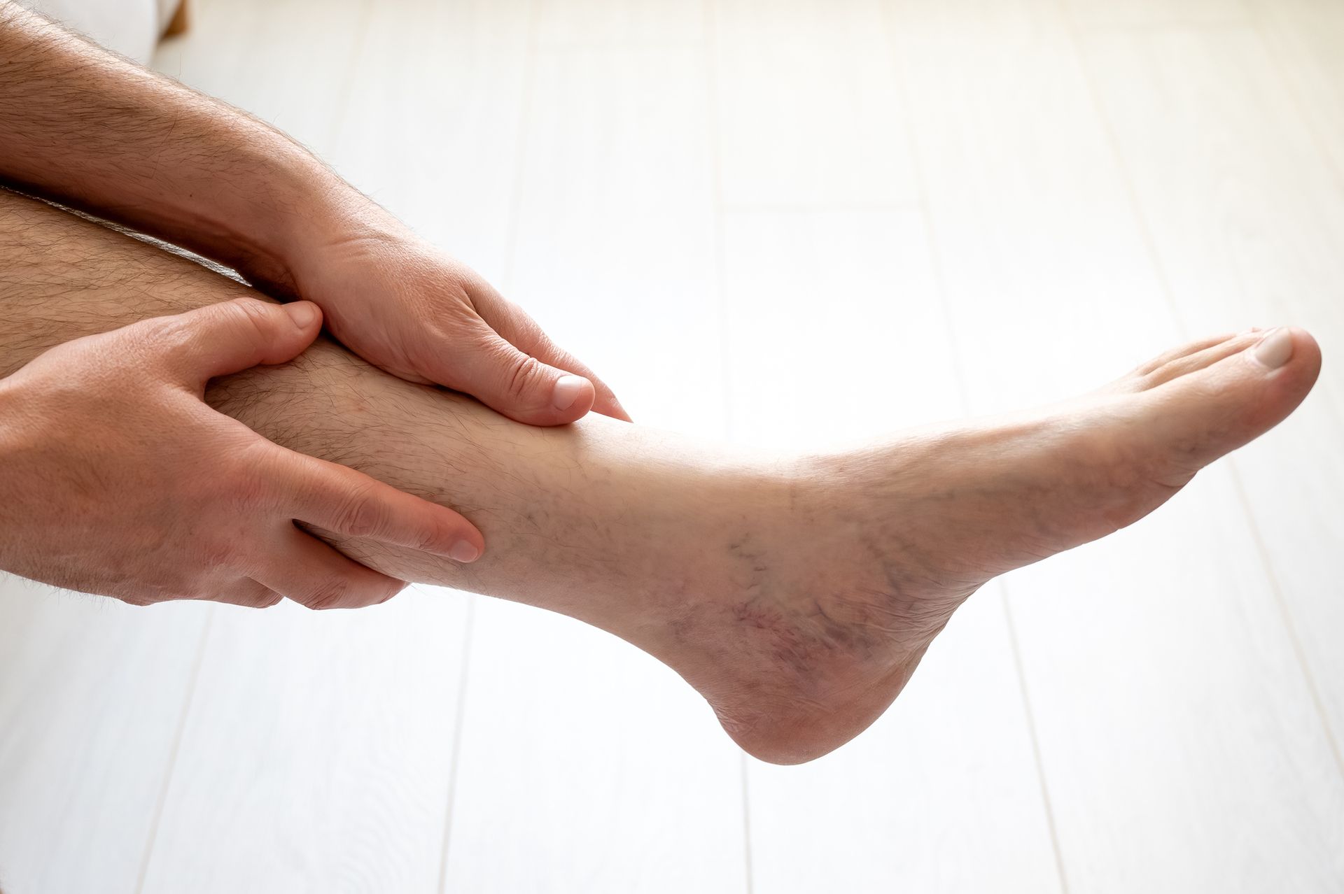 A man is holding his leg with varicose veins.