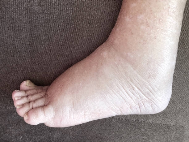 A close up of a person's foot on a couch.