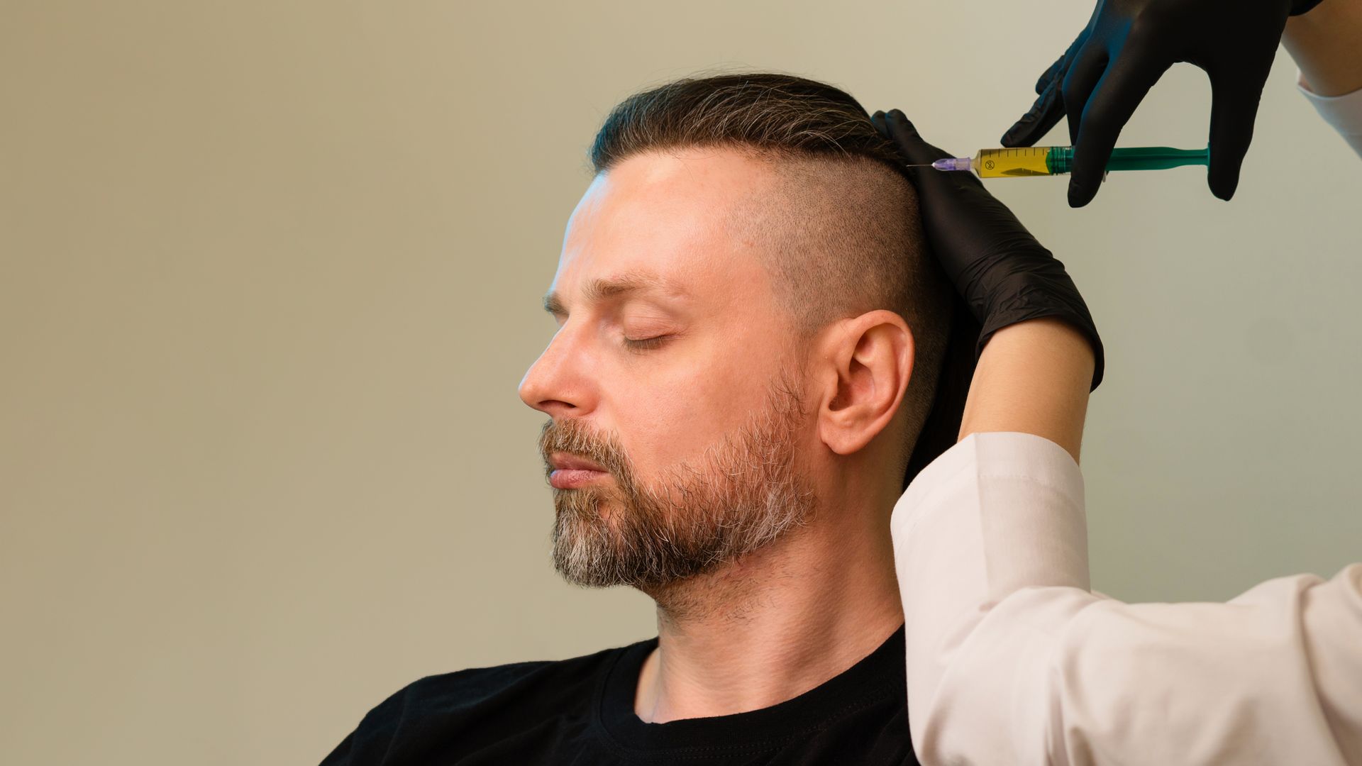 A man with a beard is getting a botox injection in his head.