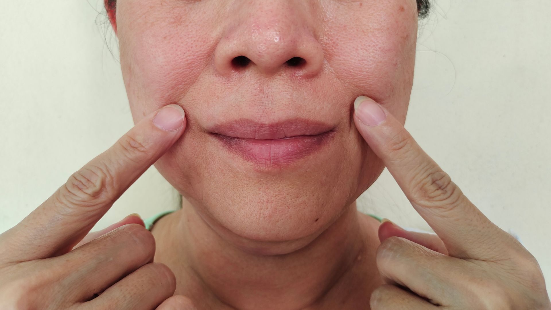Woman pointing at smile lines on her cheeks, neutral expression.