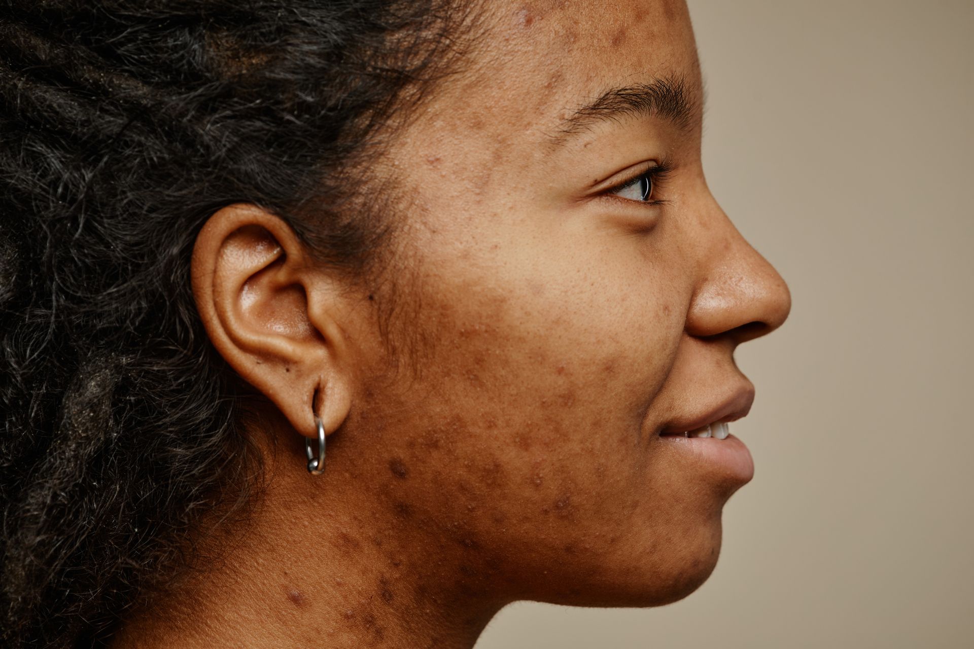 Profile of a smiling Black woman with dark skin and freckles, wearing a silver hoop earring.