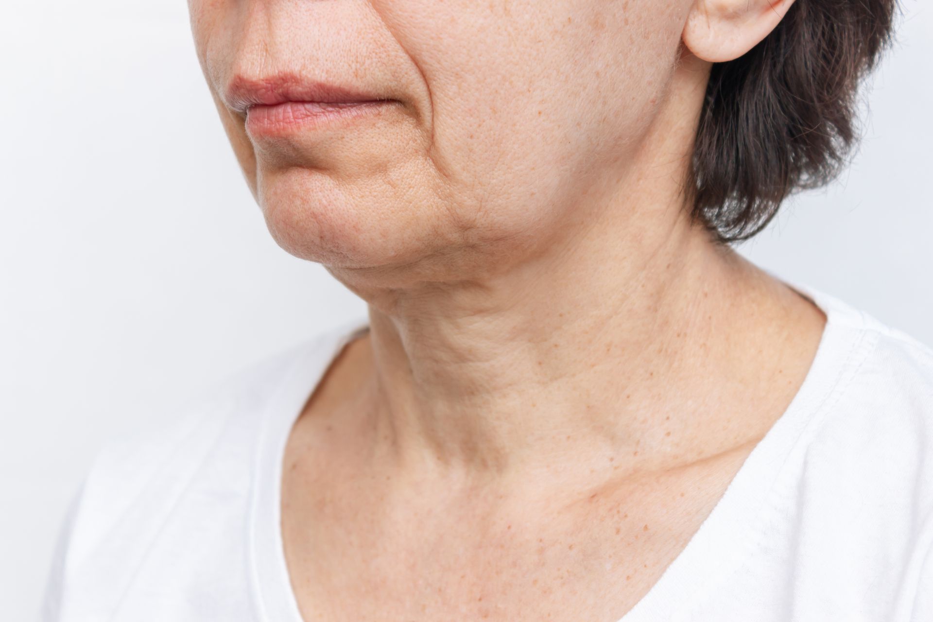 Close-up of an older woman's neck and chin, showing skin texture and wrinkles. She wears a white shirt.