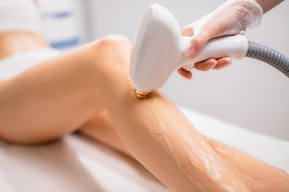 Laser hair removal on a leg; a gloved hand operates the device on a smooth, hairless skin.