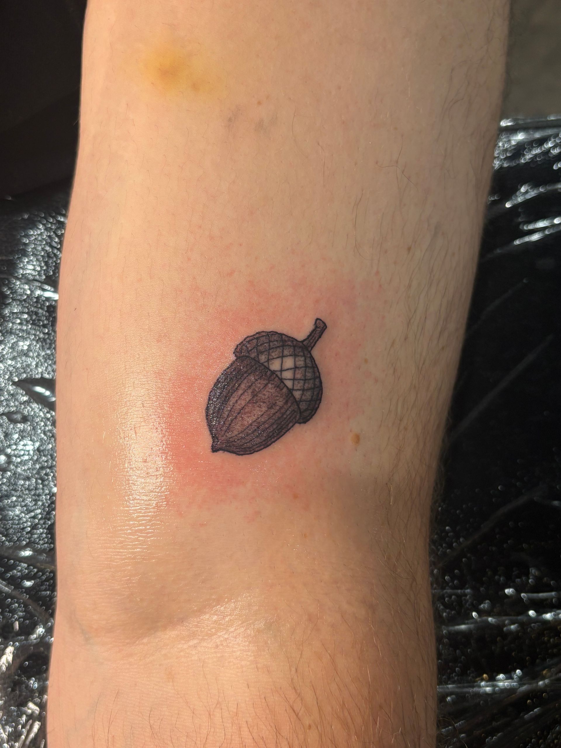 Small acorn tattoo on a person's leg, surrounded by red skin.