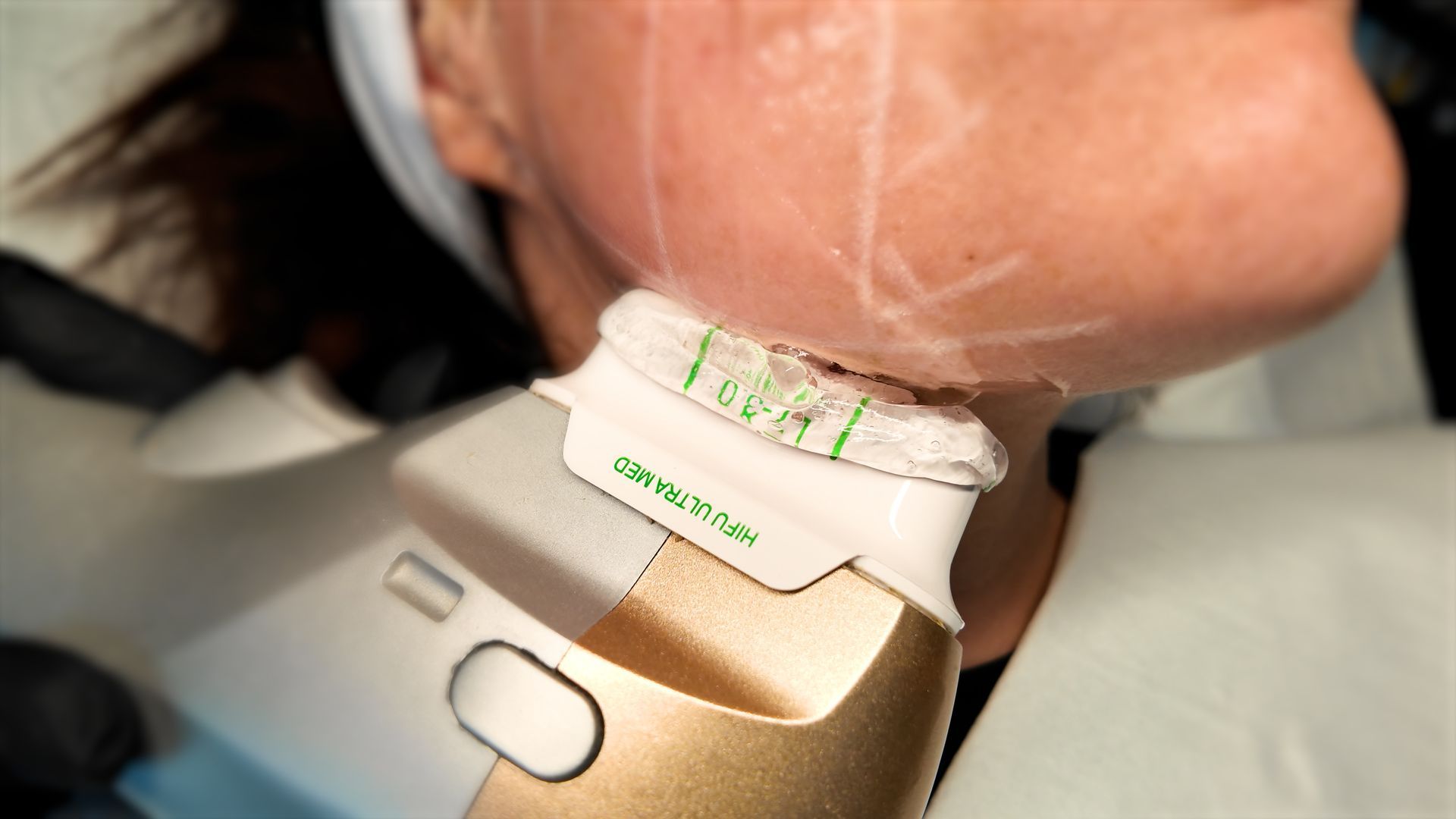 A woman is getting a treatment on her face with a machine.