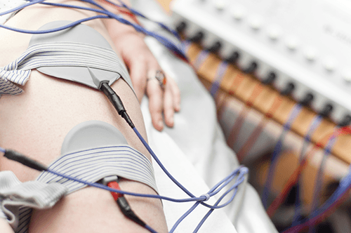 will emg nerve test still work if on steriod for pain
