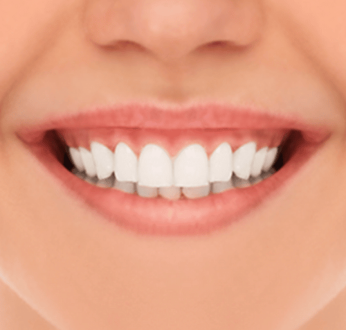 Close-up of a smiling mouth with bright, white teeth and pink lips.
