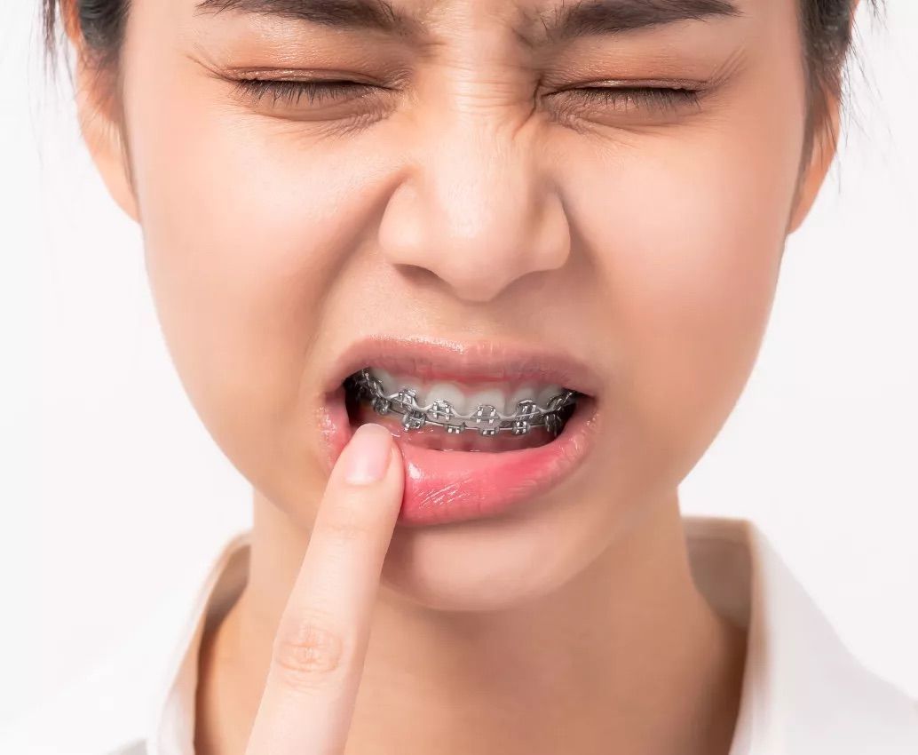Woman with braces touching her lip, grimacing in pain.