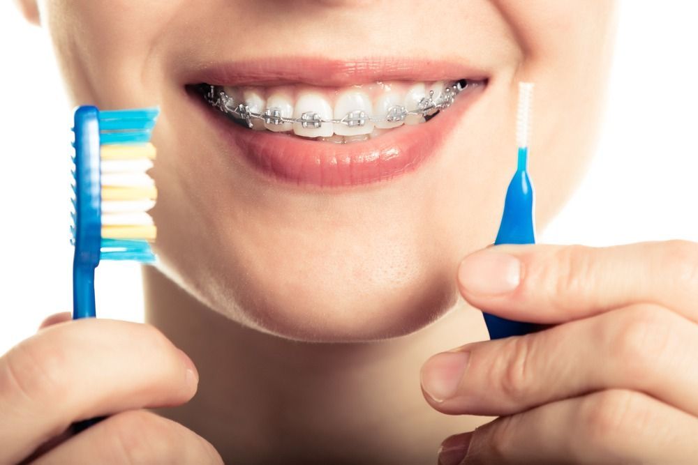 A woman with braces is brushing her teeth with a toothbrush and an interdental brush.