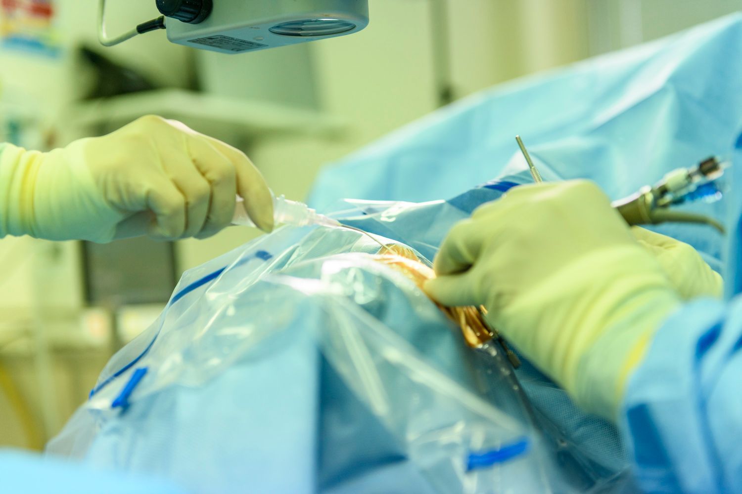 Hands in gloves during surgery, manipulating surgical tools and a draped patient.