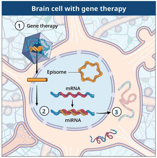 Brain Cell With Gene Therapy