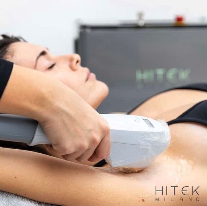 Epilazione laser