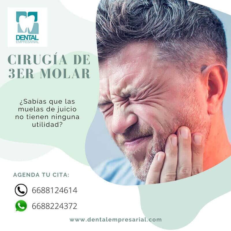 DENTAL EMPRESARIAL   -TERCER MOLAR