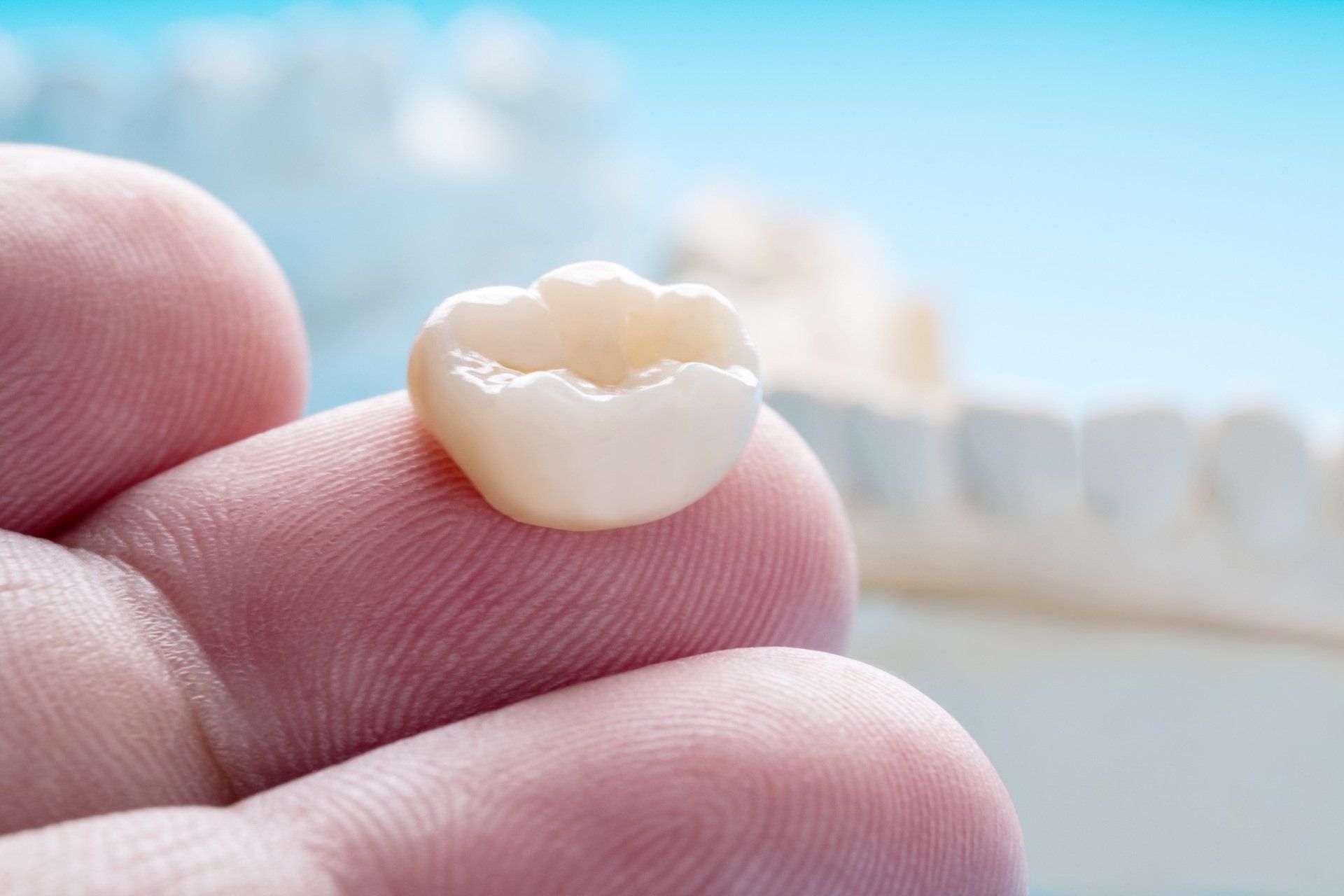 Dental Implant on fingertip