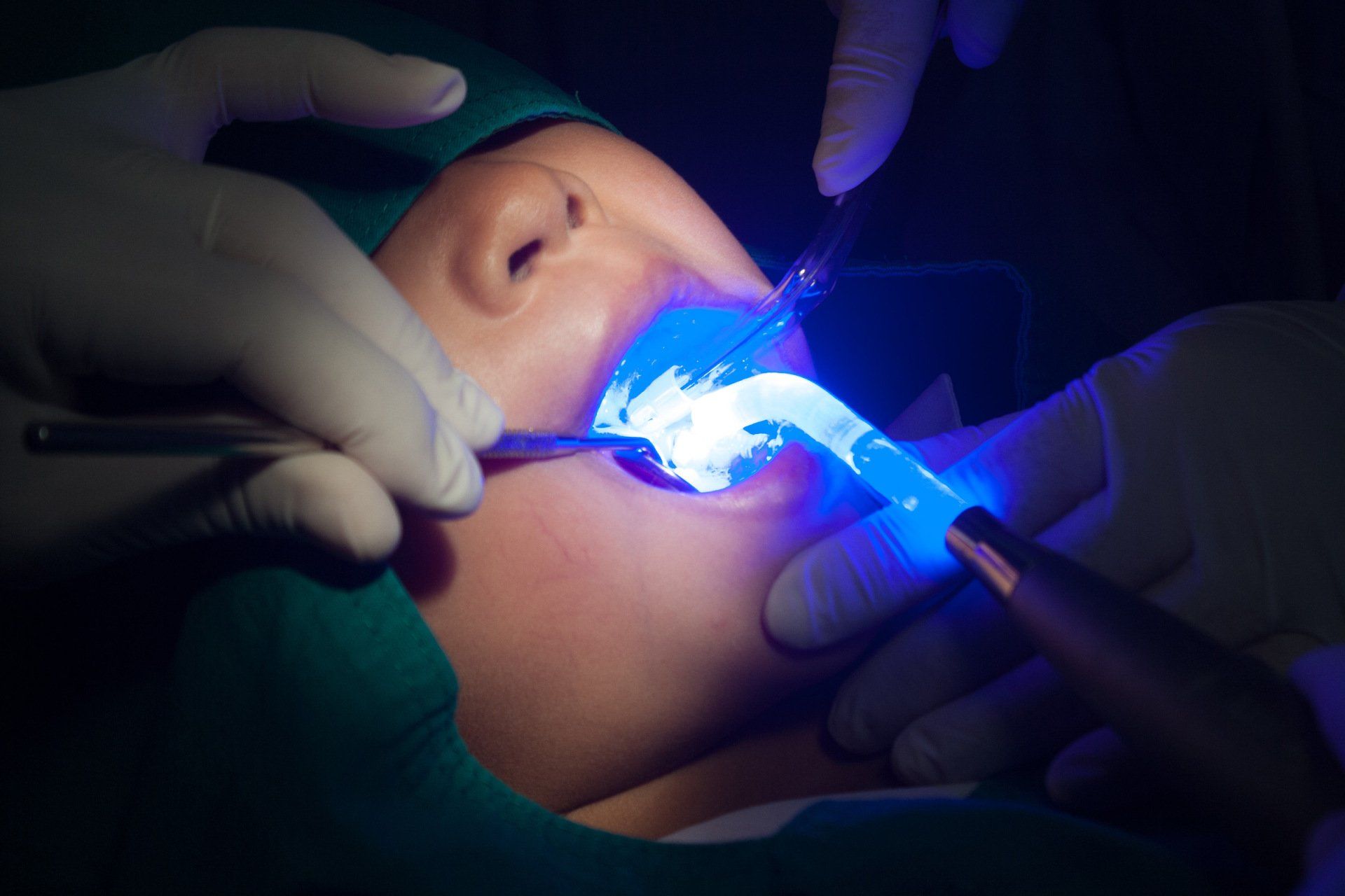 Dental Patient receiving sealants