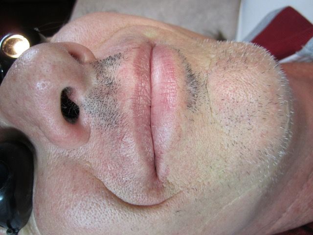 Close-up of a person's face; visible nose, mouth, and partially shaved stubble.