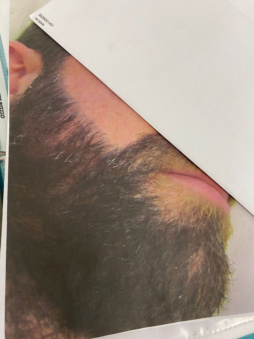 Close-up of a person's beard, with a white paper partially covering their face. The beard is dark and thick.