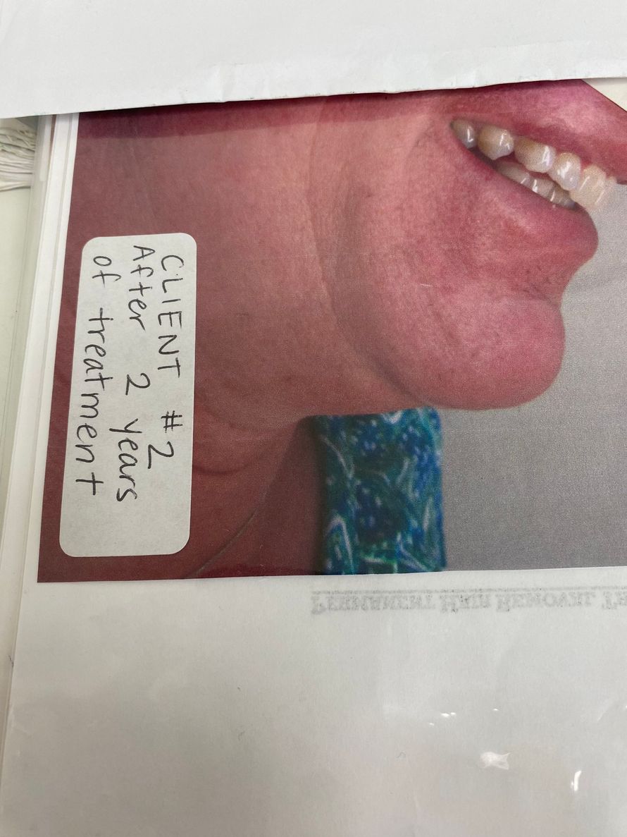 A person's smile with text 