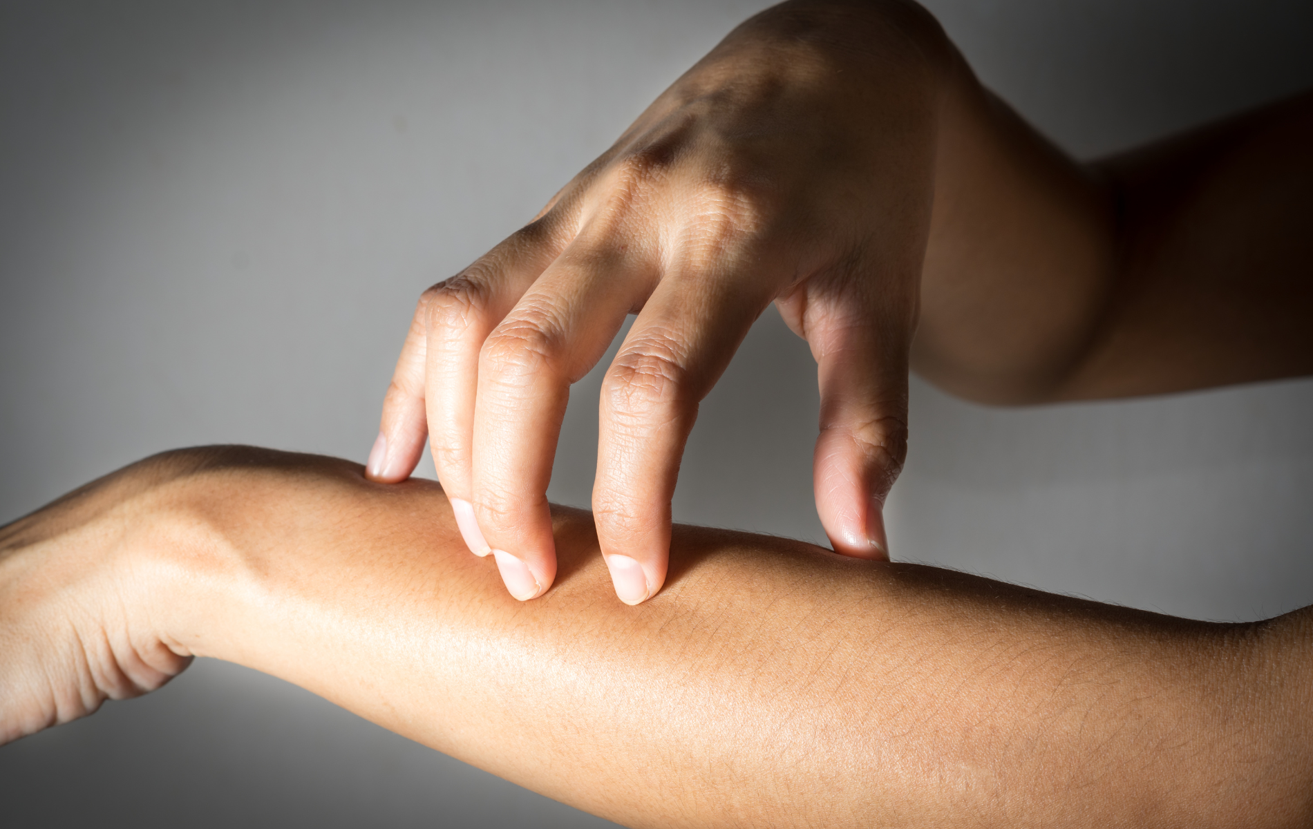 Person scratching their arm, likely due to itchiness.