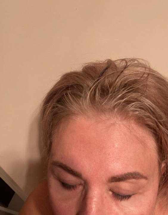 Close-up of a person's forehead, eyes closed, light brown hair, some gray roots visible.