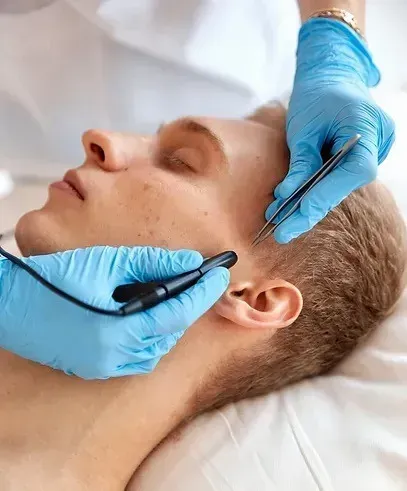 A person receiving electrolysis treatment on their face; gloved hands hold tools.