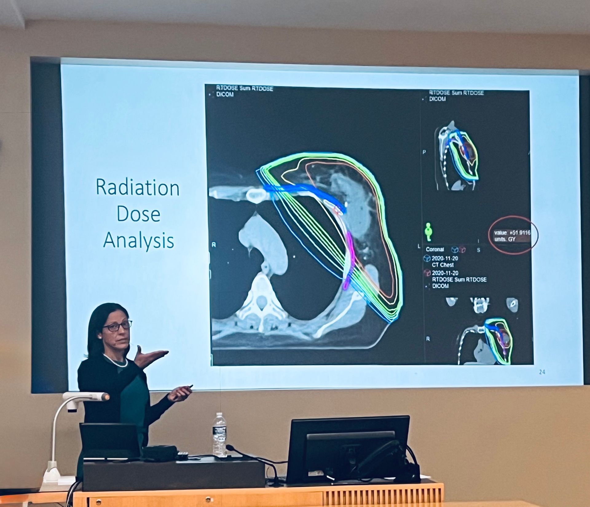 Woman presenting a radiation dose analysis on a screen, pointing to a diagram of a patient's chest.