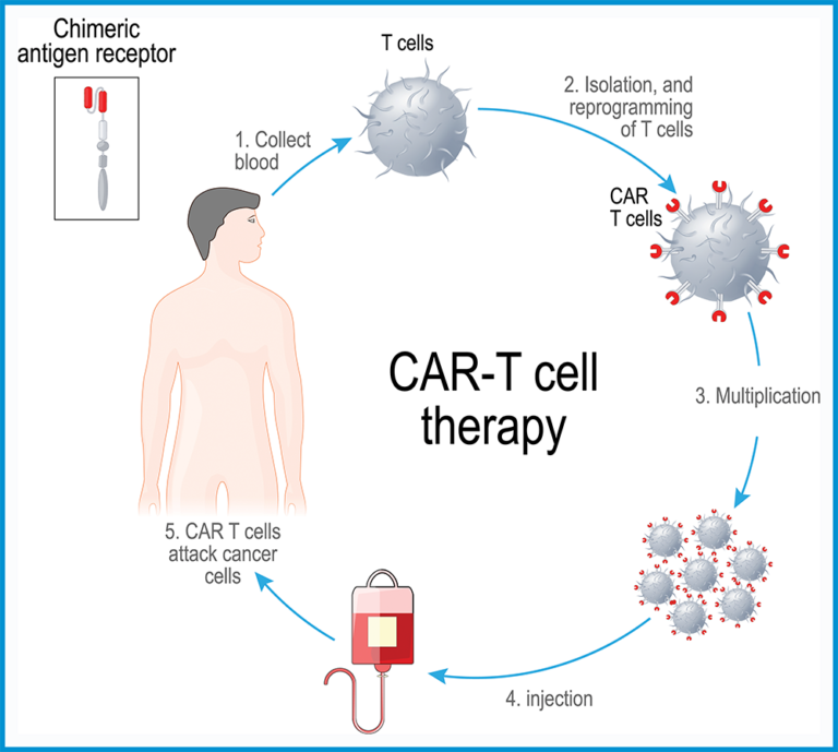 A diagram showing the process of car-t cell therapy