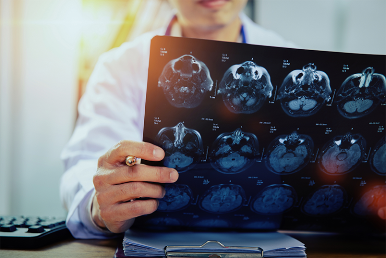 A doctor is holding a x-ray of a person 's brain.