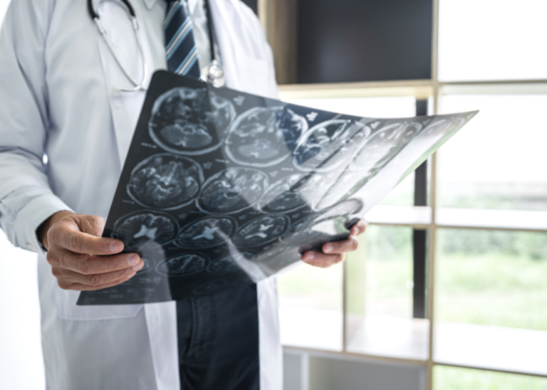 A doctor is holding a x-ray of a brain in his hands.