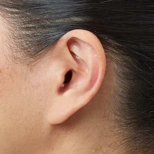 Close-up of a human ear, showing the outer ear structure against dark hair and skin.