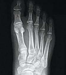 X-Ray