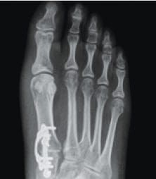 X-Ray