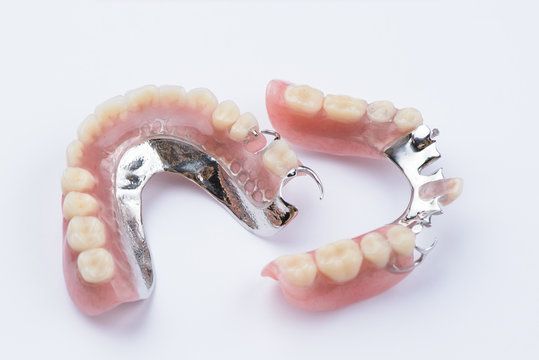 Patient receiving partial dentures for tooth replacement.