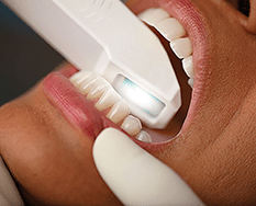 High-tech iTero scanning equipment at Central City Dentistry