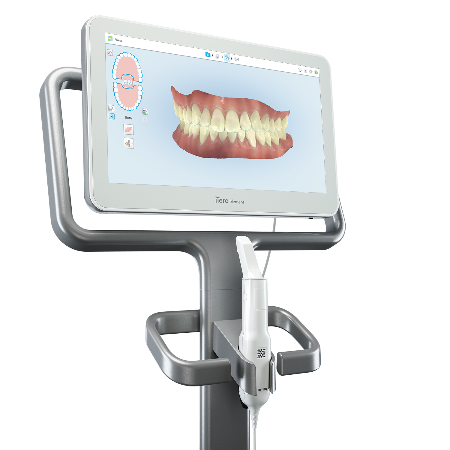 iTero digital scanning at Central City Dentistry, Concord, NH