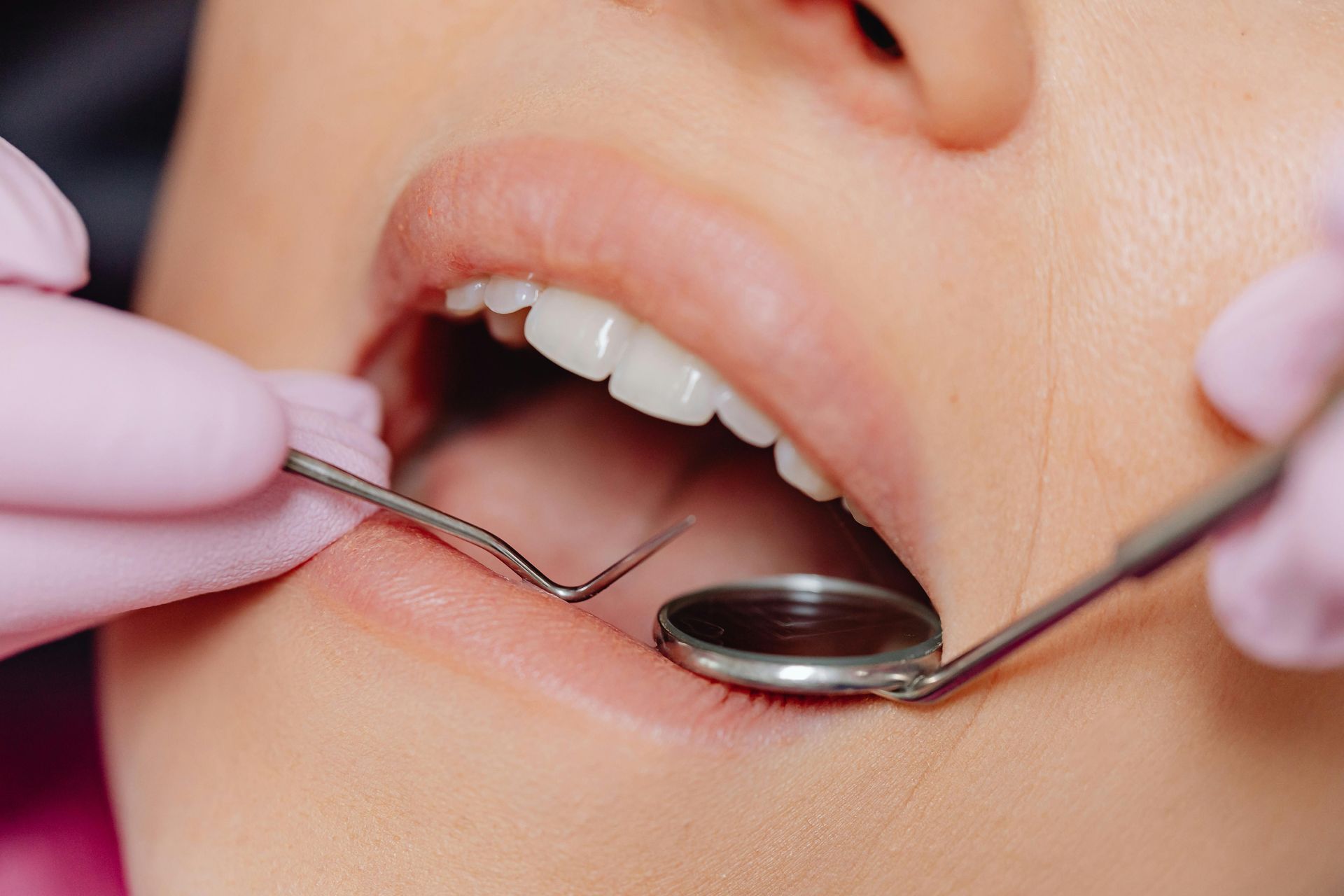 Prophylaxis treatment for dental health at Central City Dentistry.