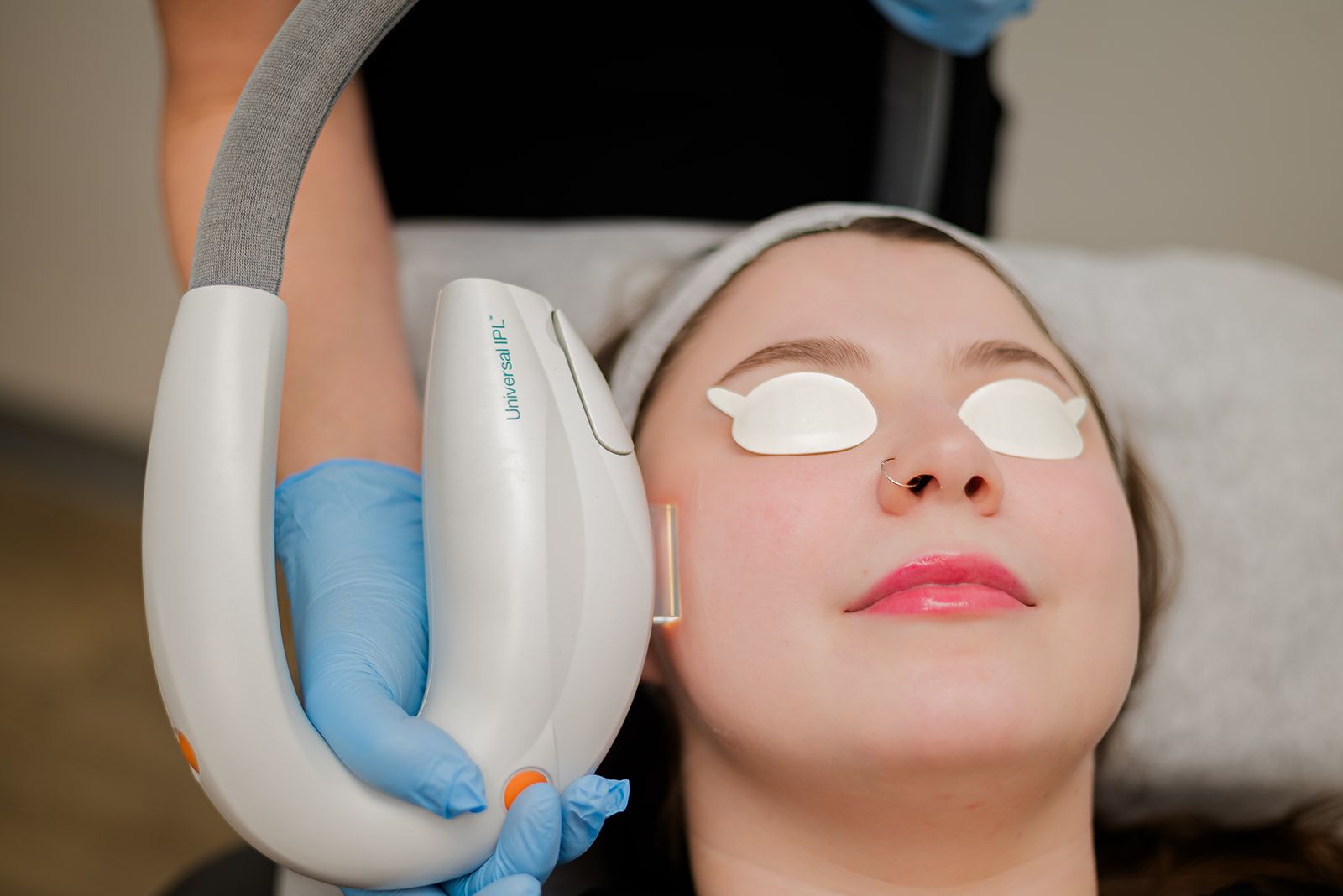 Woman receiving a IPL (intense pulsed light) treatment, eyes covered.