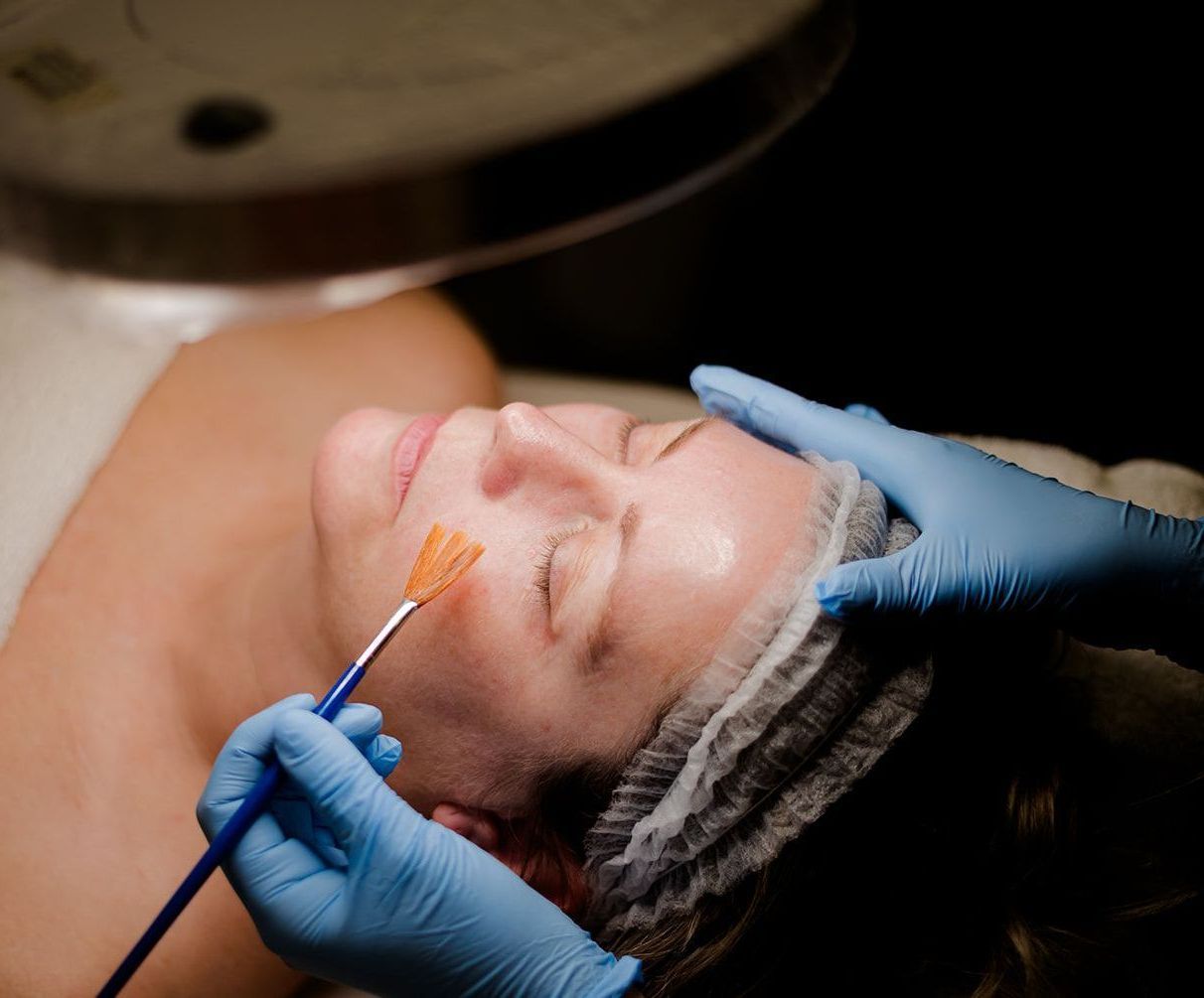 Patient receiving chemical peel treatment