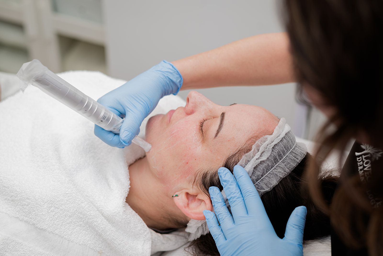Microneedling