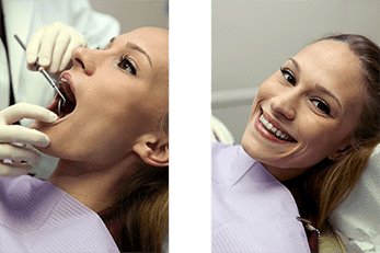Woman Before and After Treatment – Cosmetic Dentistry in Whittier, CA