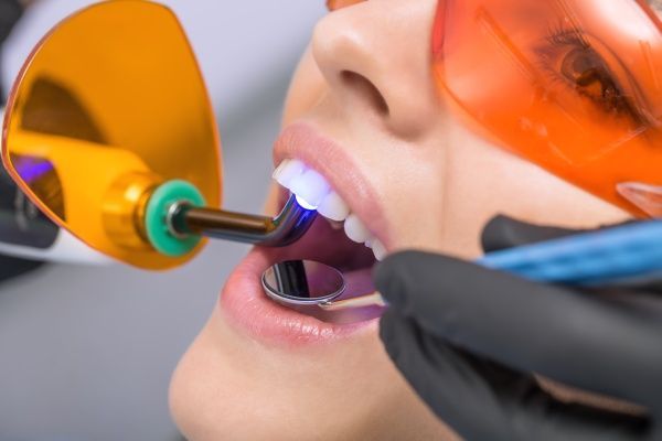 Lazerinė odontologija